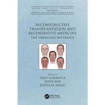Reconstructive Transplantation and Regenerative Medicine