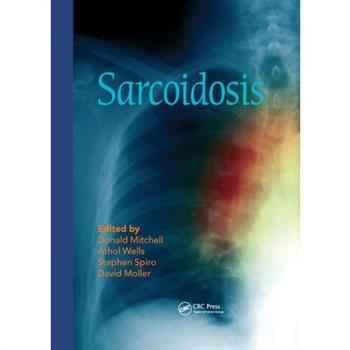Sarcoidosis