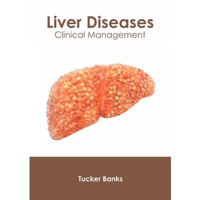 Liver Diseases: Clinical Management
