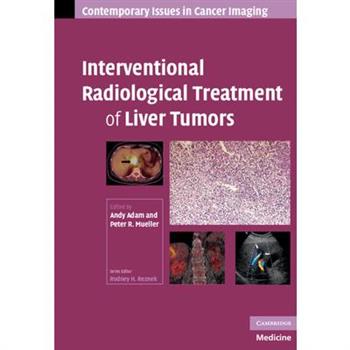 Interventional Radiological Treatment of Liver Tumors