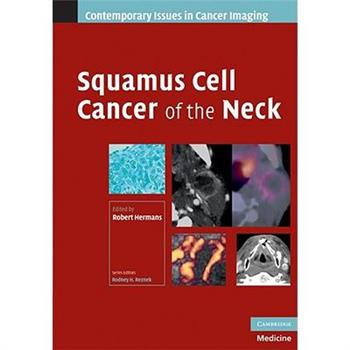 Squamous Cell Cancer of the Neck