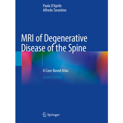 MRI of Degenerative Disease of the Spine