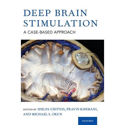 Deep Brain Stimulation