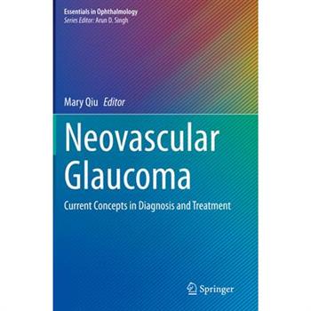 Neovascular Glaucoma