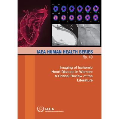 Imaging of Ischemic Heart Disease in Women: A Critical Review of the Literature