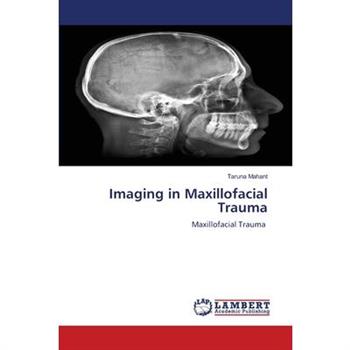 Imaging in Maxillofacial Trauma