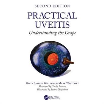 Practical Uveitis