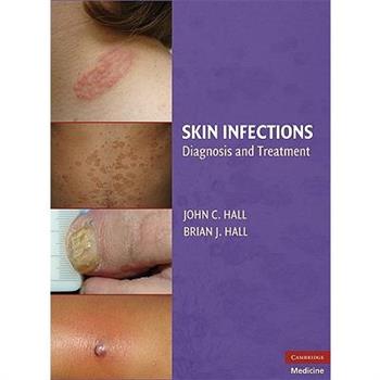 Skin Infections