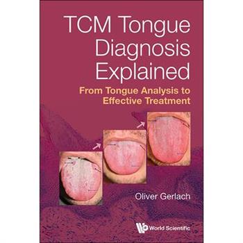Tcm Tongue Diagnosis Explained