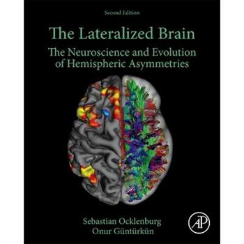 The Lateralized Brain