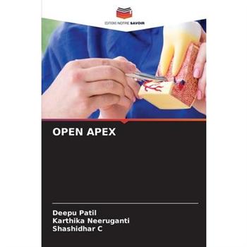 Open Apex