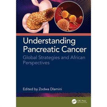 Understanding Pancreatic Cancer