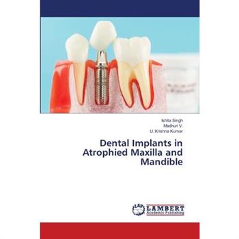 Dental Implants in Atrophied Maxilla and Mandible