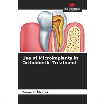Use of Microimplants in Orthodontic Treatment