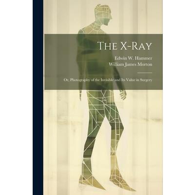 The X-Ray; Or, Photography of the Invisible and Its Value in Surgery