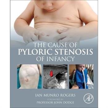 The Cause of Pyloric Stenosis of Infancy
