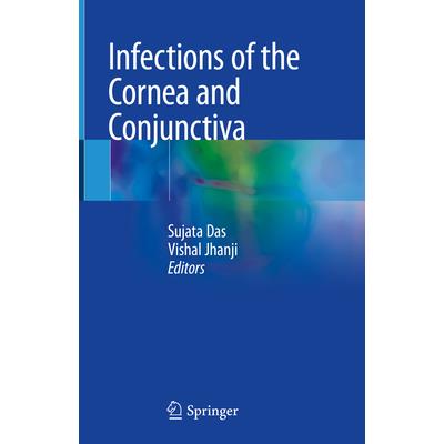 Infections of the Cornea and Conjunctiva