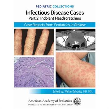 Pediatric Collections: Infectious Disease Cases: Part 2: Indolent Head Scratchers: Case Reports from Pediatrics in Review