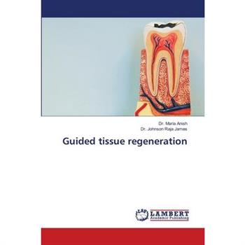 Guided tissue regeneration