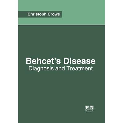 Behcet's Disease: Diagnosis and Treatment