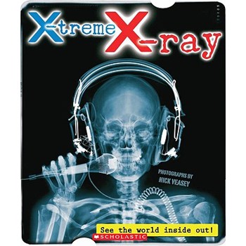 X-Treme X-ray