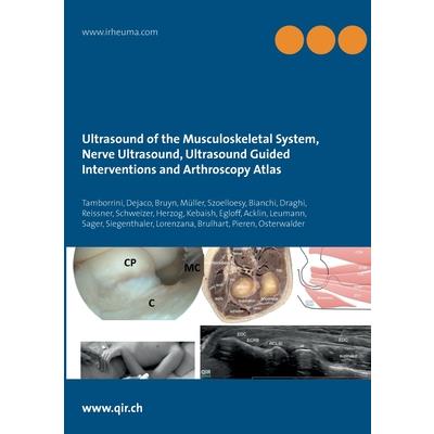 Ultrasound of the Musculoskeletal System, Nerve Ultrasound, Ultrasound Guided Interventions and Arthroscopy Atlas