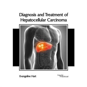 Diagnosis and Treatment of Hepatocellular Carcinoma