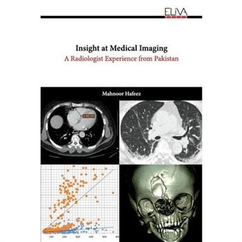 Insight at Medical Imaging
