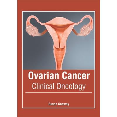 Ovarian Cancer: Clinical Oncology