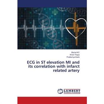 ECG in ST elevation MI and its correlation with infarct related artery