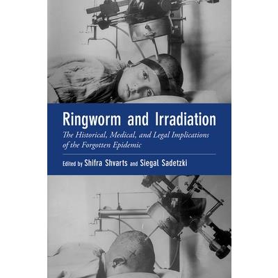Ringworm and Irradiation