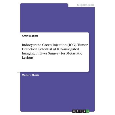Indocyanine Green Injection (ICG). Tumor Detection Potential of ICG-navigated Imaging in Liver Surgery for Metastatic Lesions