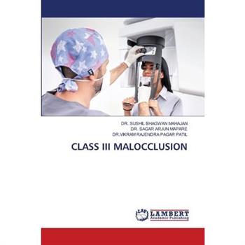 Class III Malocclusion