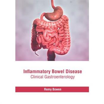 Inflammatory Bowel Disease: Clinical Gastroenterology