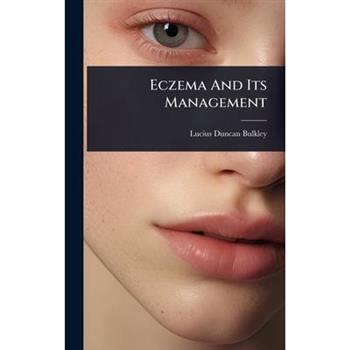 Eczema And Its Management