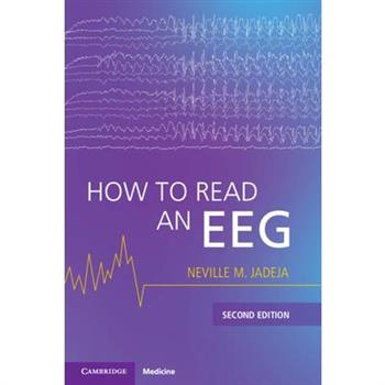 How to Read an Eeg