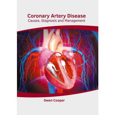 Coronary Artery Disease: Causes, Diagnosis and Management