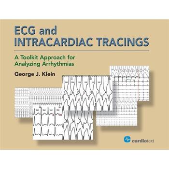 ECG and Intracardiac Tracings