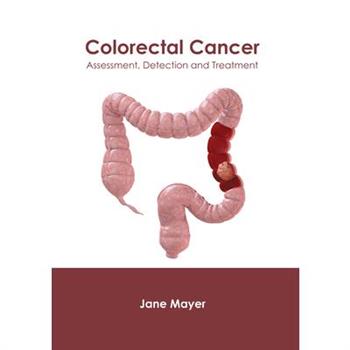 Colorectal Cancer: Assessment, Detection and Treatment