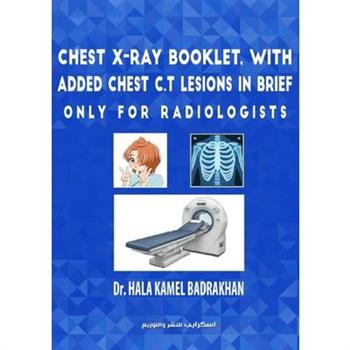 Chest X-Ray Booklet, with added Chest C.T Lesions in brief Only for Radiologists