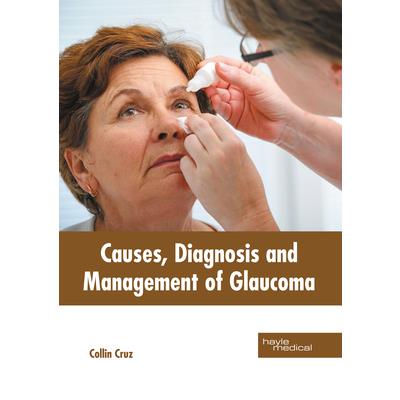 Causes, Diagnosis and Management of Glaucoma