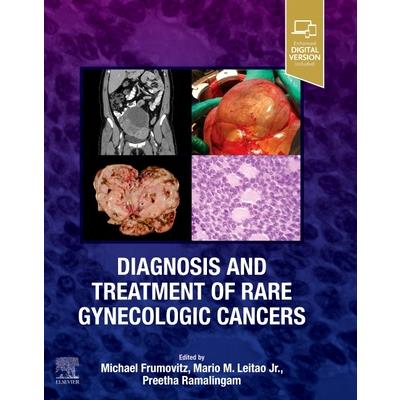 Diagnosis and Treatment of Rare Gynecologic Cancers
