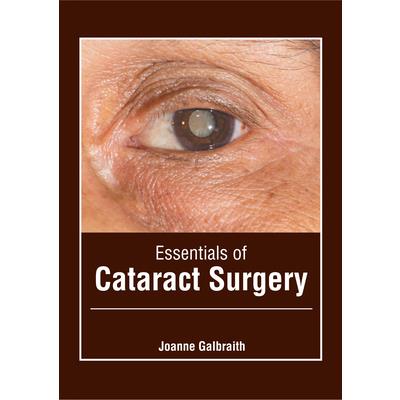 Essentials of Cataract Surgery