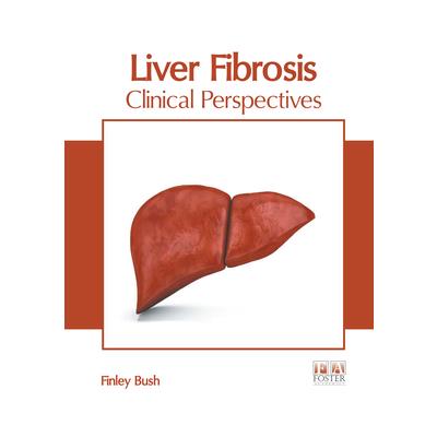 Liver Fibrosis: Clinical Perspectives