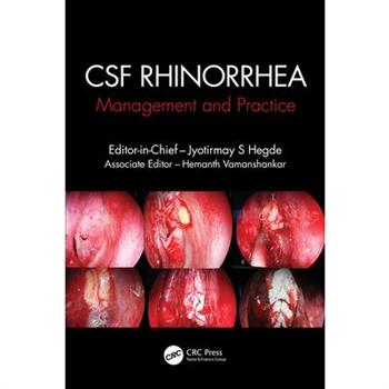 CSF Rhinorrhoea