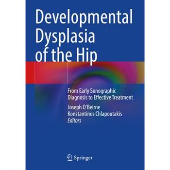 Developmental Dysplasia of the Hip