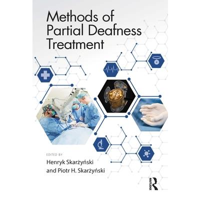 Methods of Partial Deafness Treatment