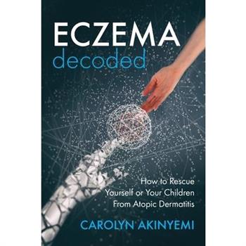 Eczema Decoded