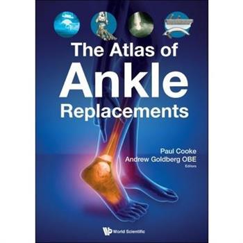 The Atlas of Ankle Replacements
