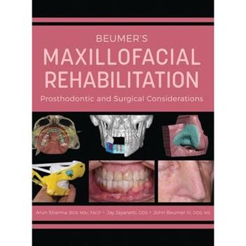 Beumer's Maxillofacial Rehabilitation